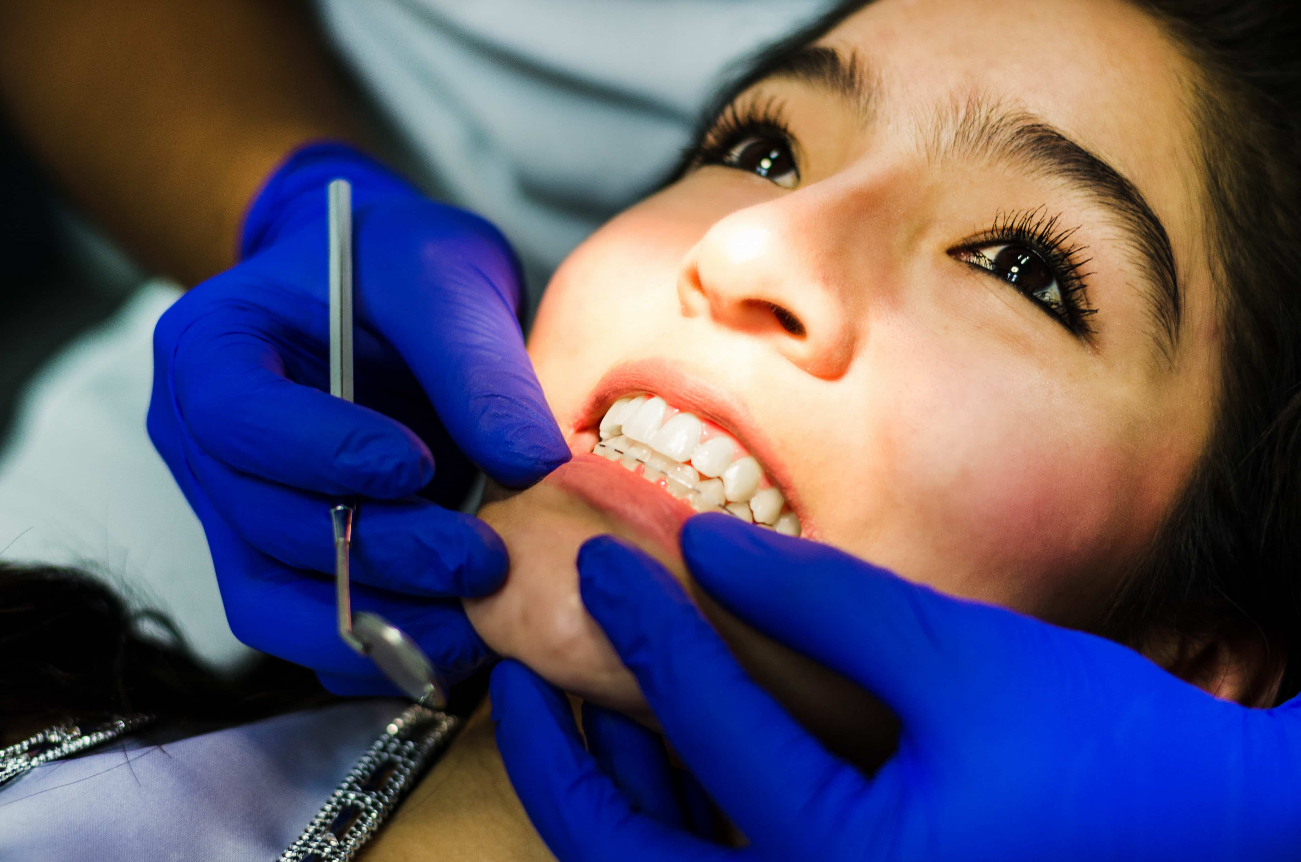 Orthodontic Treatment